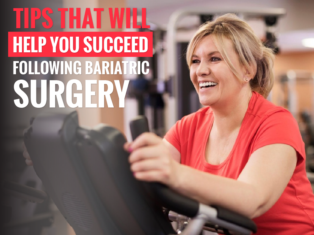 Tips That Will Help You Succeed Following Bariatric Surgery